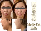 Hatten Beauty Park 810 神戸店 | 元町のエステサロン Hatten Beauty Park 810 神戸店 | 元町のエステサロン