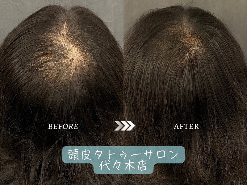 グランモア代々木店 | 代々木のエステサロン グランモア代々木店 | 代々木のエステサロン