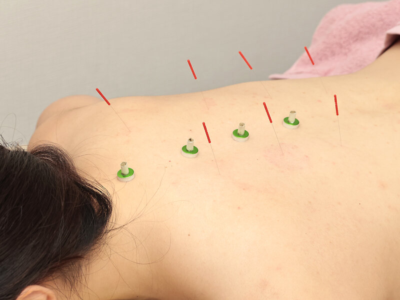 SA’S はりきゅうサロン | 須磨/垂水のリラクゼーション SA’S はりきゅうサロン | 須磨/垂水のリラクゼーション