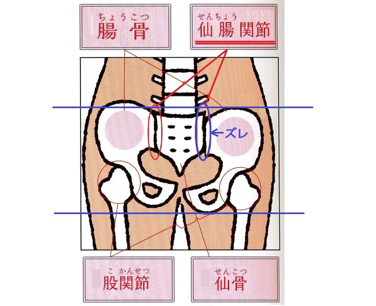 [アイキャッチ]尿もれや膀胱炎